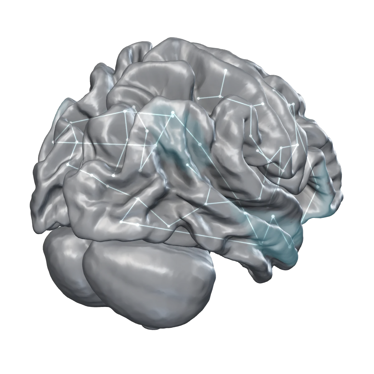 A three-dimensional model of the human brain with the default mode network highlighted.